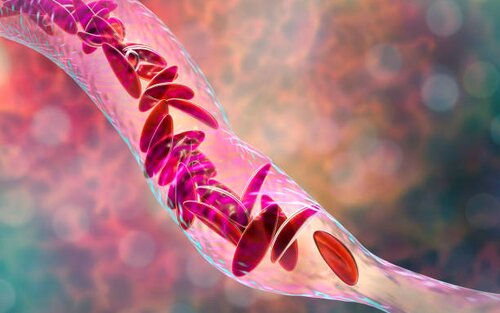 A microscopic image of sickle cells clogging in a vein | © gettyimage